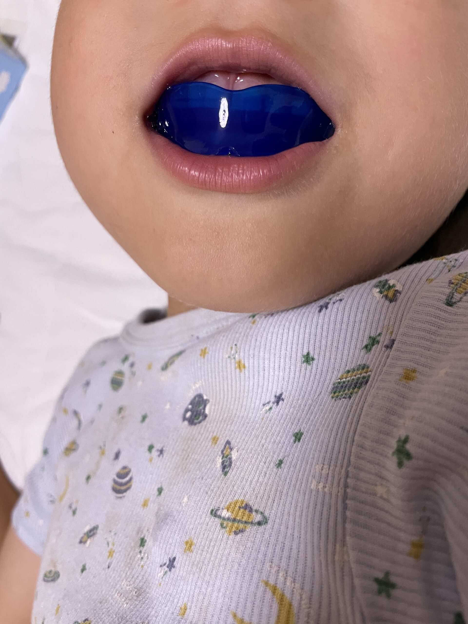 プレオルソ装着イメージ